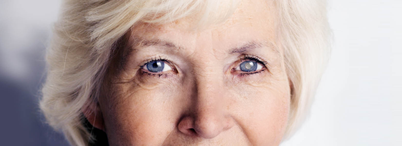Cataract Surgery in Lancaster